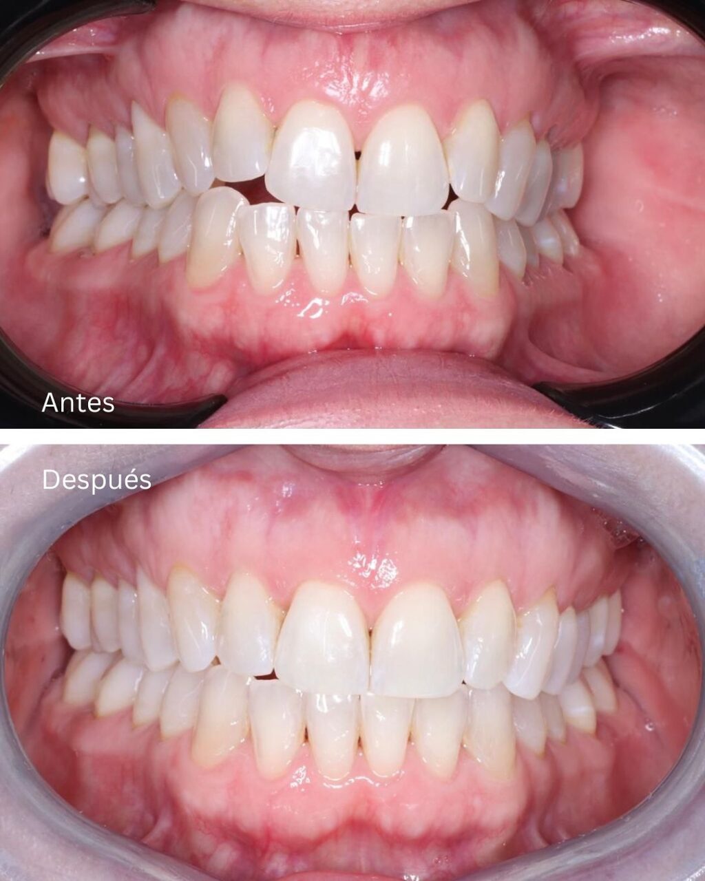 Instagram post from madenta.pa. This post is in position 1.